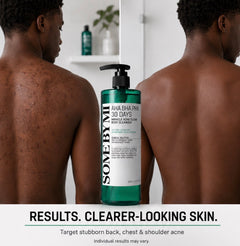 LuxeGlow™ Acne Clear Body Wash – AHA + BHA + PHA