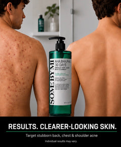 LuxeGlow™ Acne Clear Body Wash – AHA + BHA + PHA